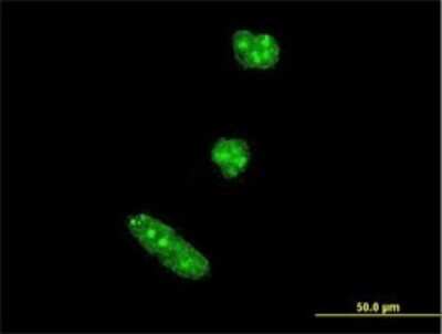 Immunocytochemistry/Immunofluorescence: Twist-1 Antibody (3A2) [H00007291-M04] - Analysis of monoclonal antibody to TWIST1 on HeLa cell. Antibody concentration 10 ug/ml