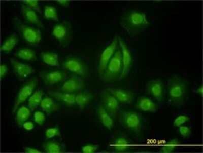 Immunocytochemistry/Immunofluorescence: Tyk2 Antibody (6G12) [H00007297-M01] - Analysis of monoclonal antibody to TYK2 on HeLa cell. Antibody concentration 10 ug/ml.