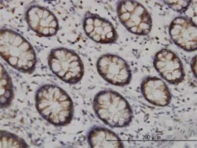 Immunohistochemistry-Paraffin: Tyk2 Antibody (6G12) [H00007297-M01] - Analysis of monoclonal antibody to TYK2 on formalin-fixed paraffin-embedded human colon. Antibody concentration 3 ug/ml.