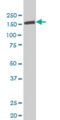 Western Blot: Tyk2 Antibody (6H1) [H00007297-M03] - Analysis of TYK2 expression in Hela S3 NE (Cat # L013V3).