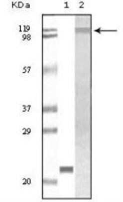 Western Blot: Tyk2 Antibody (8G9H5) [NB110-89454] - Figure 1: Western blot analysis using TYK2 mouse mAb against truncated TYK2 recombinant protein (1) and Jurkat cell lysate(2).