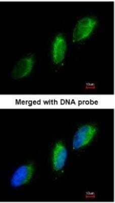 Immunocytochemistry/Immunofluorescence: Tyk2 Antibody [NBP1-32450] - Paraformaldehyde-fixed HeLa, using antibody at 1:200 dilution.