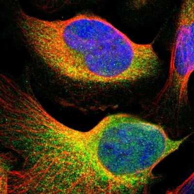 Immunocytochemistry/Immunofluorescence: Tyk2 Antibody [NBP1-87825] - Staining of human cell line U-2 OS shows localization to cytosol. Antibody staining is shown in green.