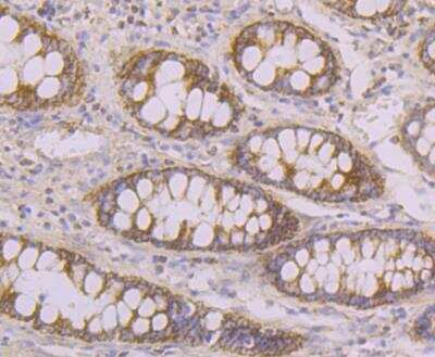 Immunohistochemistry: Tyk2 Antibody [NBP2-76968] - Immunohistochemical analysis of paraffin-embedded human colon tissue using anti- TYK2 antibody. Counter stained with hematoxylin.