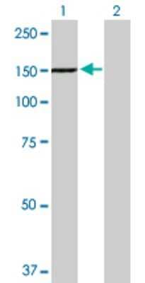 Western Blot: Tyk2 Antibody [H00007297-D01P] - Analysis of TYK2 expression in transfected 293T cell line by TYK2 polyclonal antibody.Lane 1: TYK2 transfected lysate(133.70 KDa).Lane 2: Non-transfected lysate.