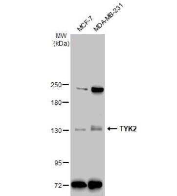 Western Blot: Tyk2 Antibody [NBP1-32450] - Various whole cell extracts (30 ug) were separated by 5% SDS-PAGE, and the membrane was blotted with TYK2 antibody [C1C3] diluted at 1:500. The HRP-conjugated anti-rabbit IgG antibody (NBP2-19301) was used to detect the primary antibody, and the signal was developed with Trident ECL plus-Enhanced.