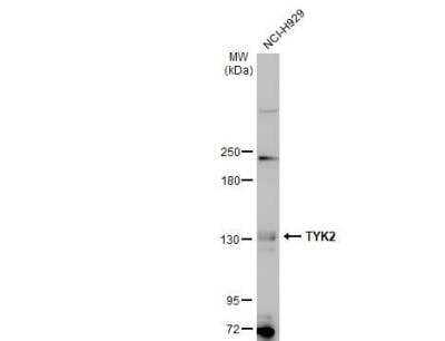 Western Blot: Tyk2 Antibody [NBP1-32450] - Whole cell extract (30 ug) was separated by 5% SDS-PAGE, and the membrane was blotted with TYK2 antibody [C1C3] diluted at 1:500. The HRP-conjugated anti-rabbit IgG antibody (NBP2-19301) was used to detect the primary antibody, and the signal was developed with Trident ECL plus-Enhanced.