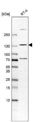 Western Blot: Tyk2 Antibody [NBP1-87825] - Analysis in human cell line RT-4.