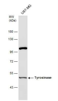 Western Blot: Tyrosinase Antibody [NBP2-20770] - Whole cell extract (30 ug) was separated by 7.5% SDS-PAGE, and the membrane was blotted with Tyrosinase antibody [N3C3]  diluted at 1:500. The HRP-conjugated anti-rabbit IgG antibody (NBP2-19301) was used to detect the primary antibody.