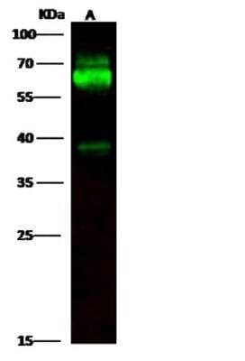 Western Blot: Tyrosine Hydroxylase Antibody (001) [NBP2-90761] - Anti-TH rabbit monoclonal antibody at 1:500 dilution. PC12 Whole Cell Lysate (30 ug per lane. Secondary antibody Goat Anti-Rabbit IgG H&L (DyLight800) at 1:10000 dilution. Developed using the Odyssey technique. Performed under reducing conditions. Predicted band size: 58 kDa. Observed band size: 63 kDa.