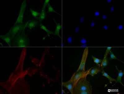 Immunocytochemistry/Immunofluorescence: Tyrosine Hydroxylase Antibody (5C7.2E8) - Azide and BSA Free [NBP2-81002] - PC-12 cells were fixed for 10 minutes using 10% formalin and then permeabilized for 5 minutes using 1X TBS + 0.5% Triton X-100. The cells were incubated with Tyrosine Hydroxylase (5C7.2E8) at a 1:100 dilution overnight at 4 degrees C and detected with DyLight 488 (green). Actin was detected with Phalloidin 568 (red) at a 1:200 dilution. Nuclei were detected with DAPI (blue). Cells were imaged using a 40X objective. Image from the standard format of this antibody.
