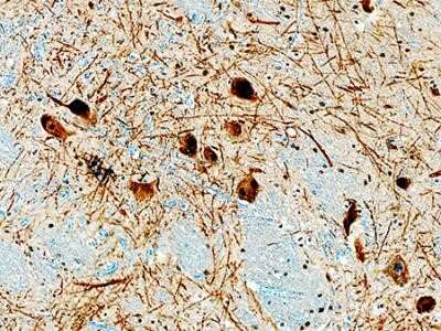 Immunohistochemistry: Tyrosine Hydroxylase Antibody (5C7.2E8) - Azide and BSA Free [NBP2-81002] - Immunohistochemical analysis of a FFPE tissue section of human brain/substantia nigra using Tyrosine Hydroxylase antibody (clone 5C7.2E8) at 15 ug/mL. This representative photomicrograph shows strong immunostaining of tyrosine hydroxylase/TH in TH-positiv
