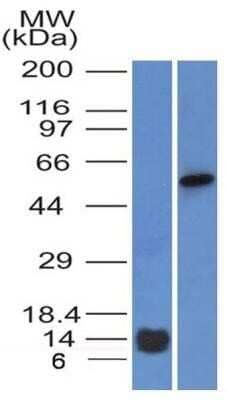 Western Blot: Tyrosine Hydroxylase Antibody (5C7.2E8) - Azide and BSA Free [NBP2-81002] - Western blot analysis of a partial recombinant human Tyrosine Hydroxylase protein and a lysate of HEK293 cells using 3 ug/mL of Tyrosine Hydroxylase antibody clone 5C7.2E8. The antibody detected ~11 kDa and ~58 kDa specific bands representing the recombinant and the endogenous TH proteins respectively. Image from the standard format of this antibody.