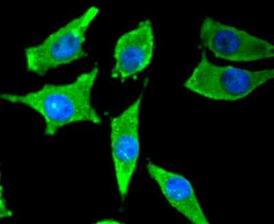 Immunocytochemistry/Immunofluorescence: Tyrosine Hydroxylase Antibody (SD080-02) [NBP2-67797] - Tyrosine Hydroxylase in SH-SY-5Y cells (green). The nuclear counter stain is DAPI (blue). Cells were fixed in paraformaldehyde, permeabilised with 0.25% Triton X-100 in PBS.