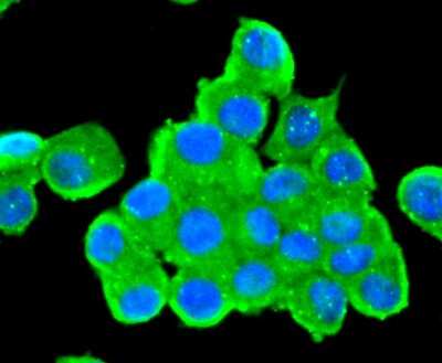 Immunocytochemistry/Immunofluorescence: Tyrosine Hydroxylase Antibody (SD080-02) [NBP2-67797] - Tyrosine Hydroxylase in N2A cells (green). The nuclear counter stain is DAPI (blue). Cells were fixed in paraformaldehyde, permeabilised with 0.25% Triton X-100 in PBS.