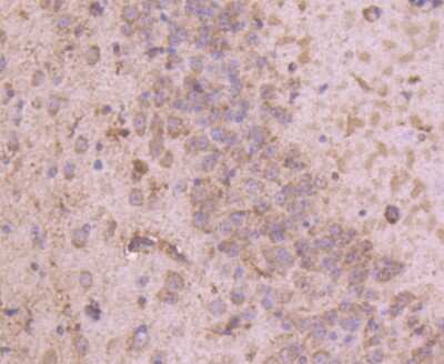 Immunohistochemistry-Paraffin: Tyrosine Hydroxylase Antibody (SD080-02) [NBP2-67797] - Analysis of paraffin-embedded mouse brain tissue using anti-Tyrosine Hydroxylase antibody. Counter stained with hematoxylin.