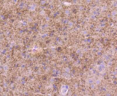 Immunohistochemistry-Paraffin: Tyrosine Hydroxylase Antibody (SD080-02) [NBP2-67797] - Analysis of paraffin-embedded rat brain tissue using anti-Tyrosine Hydroxylase antibody. Counter stained with hematoxylin.