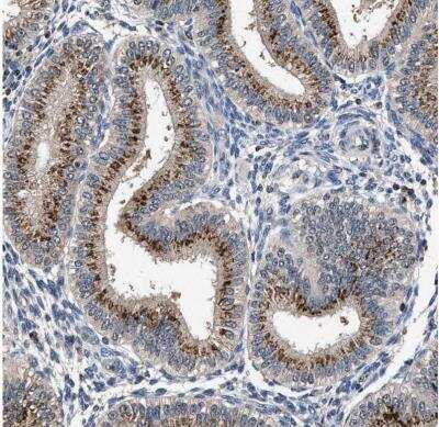 Immunohistochemistry-Paraffin: Tyrosylprotein Sulfotransferase 2/TPST2 Antibody [NBP1-86023] - Staining of human endometrium shows strong granular positivity in cytoplasm in glandular cells.