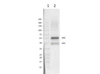 Western Blot: U-87 MG Whole Cell Lysate [NBP3-06996] - Western Blot Results of Rabbit Anti-SQSTM1/p62 Antibody using U-87 MG Whole Cell lysate. Western Blot of Rabbit Anti-SQSTM1/p62 Antibody.Lane 1: Opal Prestain Molecular Weight Marker. Lane 2: U-87 MG whole cell lysate. Load: 35ug lysate per lane. Primary Antibody: Anti-SQSTM1 at 1:1000 overnight at 2-8C. Secondary Antibody: Goat Anti-Rabbit IgG HRP at 1:40,000 for 60 mins at RT. Block: 5% BLOTTO/TBST. Predicted MW: ~48 kDa. Observed MW: ~45, 60kDa. Protein undergoes acetylation, Isopeptide bond, Phosphoprotein, and Ubl conjugation.