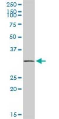Western Blot: U1A Antibody [H00006626-D01P] - Analysis of SNRPA expression in human kidney.