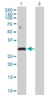 Western Blot: U1A Antibody [H00006626-D01P] - Analysis of SNRPA expression in transfected 293T cell line by SNRPA polyclonal antibody.Lane 1: SNRPA transfected lysate(31.30 KDa).Lane 2: Non-transfected lysate.