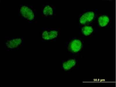 Immunocytochemistry/ Immunofluorescence U2AF1L4 Antibody