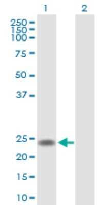 Western Blot U2AF1L4 Antibody