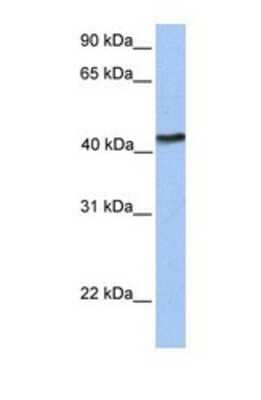 Western Blot: U2AF1L4 Antibody [NBP1-69417] - This Anti-TMEM149 antibody was used in Western Blot of Fetal Brain tissue lysate at a concentration of 1ug/ml.