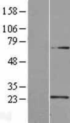 Western Blot: U2AF1L4 Overexpression Lysate (Adult Normal) [NBL1-17492] Left-Empty vector transfected control cell lysate (HEK293 cell lysate); Right -Over-expression Lysate for U2AF1L4.