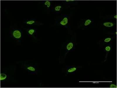 Immunocytochemistry/Immunofluorescence: U2AF2 Antibody (5G8) [H00011338-M03] - Analysis of monoclonal antibody to U2AF2 on HeLa cell. Antibody concentration 10 ug/ml