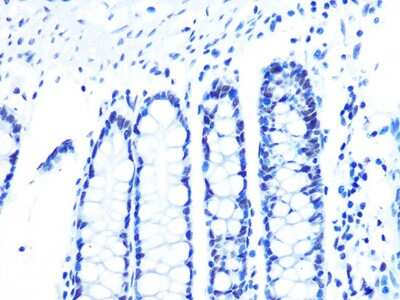 Immunohistochemistry-Paraffin: U2AF2 Antibody (8E8R9) [NBP3-16432] - Immunohistochemistry of paraffin-embedded human colon using U2AF2/U2AF2 Rabbit mAb (NBP3-16432) at dilution of 1:100 (40x lens).Perform microwave antigen retrieval with 10 mM PBS buffer pH 7.2 before commencing with IHC staining protocol.