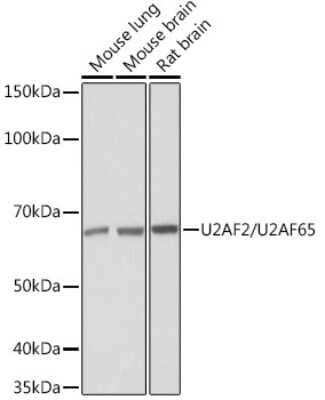 Western Blot: U2AF2 Antibody (8E8R9) [NBP3-16432] - Western blot analysis of extracts of various cell lines, using U2AF2/U2AF2 Rabbit mAb (NBP3-16432) at 1:1000 dilution. Secondary antibody: HRP Goat Anti-Rabbit IgG (H+L) at 1:10000 dilution. Lysates/proteins: 25ug per lane. Blocking buffer: 3% nonfat dry milk in TBST. Detection: ECL Basic Kit. Exposure time: 10s.