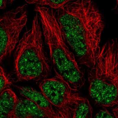 Immunocytochemistry/Immunofluorescence: U2AF2 Antibody [NBP2-58989] - Staining of human cell line HEK 293 shows localization to nuclear speckles.