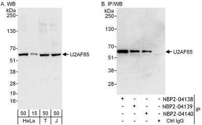 Immunoprecipitation: U2AF2 Antibody [NBP2-04139] - Samples:  Whole cell lysate from HeLa (15 and 50 ug for WB; 1 mg for IP, 20% of IP loaded), 293T (T; 50 ug) and Jurkat (J; 50 ug) cells.  Antibodies: Affinity purified rabbit anti-U2AF65 antibody NBP2-04138 used for WB at 0.1 ug/ml (A) and 1 ug/ml (B) and used for IP at 6 ug/mg lysate.  U2AF65 was also immunoprecipitated by rabbit anti-U2AF65 antibodies NBP2-04139 and NBP2-04140, which recognize downstream epitopes.  Detection: Chemiluminescence with exposure times of 10 seconds (A and B).