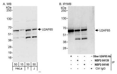 <b>Independent Antibodies Validation. </b>Immunoprecipitation: U2AF2 Antibody [NBP2-04139] - Detection of human U2AF65 by western blot and immunoprecipitation. Samples: Whole cell lysate from HeLa (15 and 50 ug for WB; 1 mg for IP, 20% of IP loaded), HEK293T (T; 50 ug) and Jurkat (J; 50 ug) cells. Antibodies: Affinity purified rabbit anti-U2AF65 antibody NBP2-04139 used for WB at 0.1 ug/ml (A) and 1 ug/ml (B) and used for IP at 6 ug/mg lysate. U2AF65 was also immunoprecipitated by rabbit anti-U2AF65 antibodies NBP2-04139 and one other rabbit anti-U2AF65 antibody, which recognize other epitopes. Detection: Chemiluminescence with exposure times of 30 seconds (A) and 10 seconds (B).