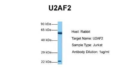 Western Blot: U2AF2 Antibody [NBP1-57251] - Sample Tissue: Human Jurkat Antibody Dilution: 1.0 ug/ml