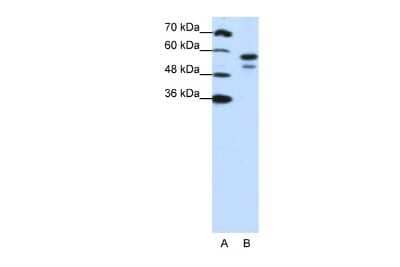 Western Blot: U2AF2 Antibody [NBP1-57251] - Reccomended Titration: 1.25 ug/ml Positive Control: Jurkat cell lysate U2AF2 is strongly supported by BioGPS gene expression data to be expressed in Human Jurkat cells