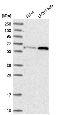 Western Blot: U2AF2 Antibody [NBP2-58989] - Analysis in human cell line RT-4 and human cell line U-251 MG.