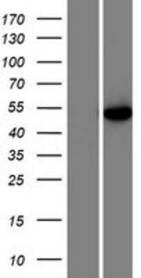 Western Blot: U2AF2 Overexpression Lysate (Adult Normal) [NBP2-07511] Left-Empty vector transfected control cell lysate (HEK293 cell lysate); Right -Over-expression Lysate for U2AF2.