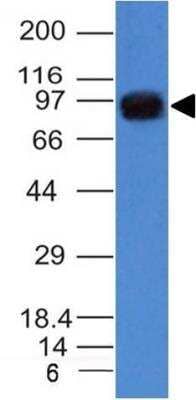 Western Blot: UACA Antibody (AE-5) - Azide and BSA Free [NBP2-36444] - Western Blot of A549 cell lysate using UACA Antibody (AE-5) - Azide and BSA Free