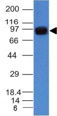 Western Blot: UACA Antibody (AE-5) - Azide and BSA Free [NBP3-11314] - Western Blot of A549 cell lysate.