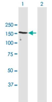 Western Blot: UACA Antibody [H00055075-B03P] - Analysis of UACA expression in transfected 293T cell line. Lane 1: UACA transfected lysate (162.50 KDa). Lane 2: Non-transfected lysate.