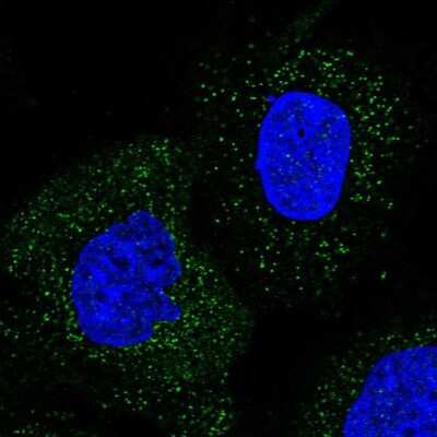 Immunocytochemistry/Immunofluorescence: UAF1/WDR48 Antibody [NBP1-81404] - Staining of human cell line A-431 shows localization to vesicles. Antibody staining is shown in green.