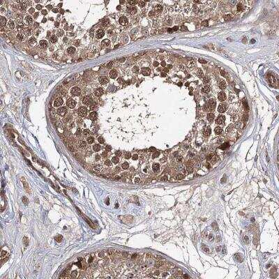 Immunohistochemistry-Paraffin: UAF1/WDR48 Antibody [NBP1-81404] - Staining of human testis shows moderate to strong positivity.