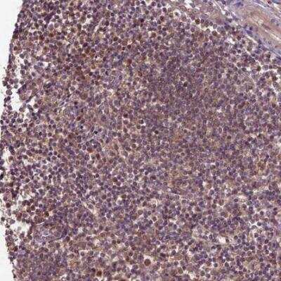 Immunohistochemistry-Paraffin: UAF1/WDR48 Antibody [NBP2-49269] - Staining of human tonsil shows moderate nuclear positivity in subset of non-germinal center cells.