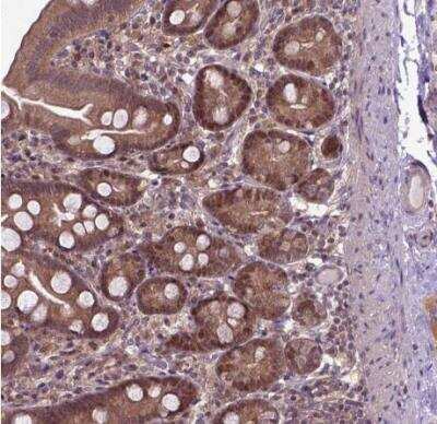 Immunohistochemistry-Paraffin: UAF1/WDR48 Antibody [NBP2-49269] - Staining of human small intestine shows moderate nuclear and cytoplasmic positivity in glandular cells.
