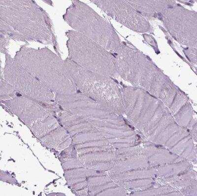 Immunohistochemistry-Paraffin: UAF1/WDR48 Antibody [NBP2-49269] - Staining of human skletal muscle shows no positivity in myocytes as expected.
