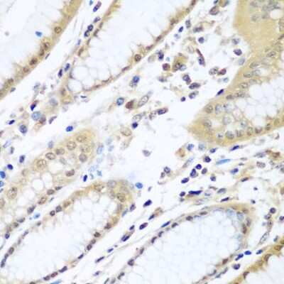 Immunohistochemistry-Paraffin: UAF1/WDR48 Antibody [NBP2-95220] - Paraffin-embedded human stomach using UAF1/WDR48 .