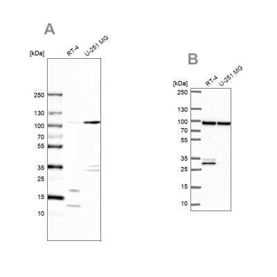 Western Blot: UAF1/WDR48 Antibody [NBP1-81404] - Analysis using Anti-WDR48 antibody NBP1-81404 (A) shows similar pattern to independent antibody NBP2-49269 (B).