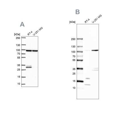 Western Blot: UAF1/WDR48 Antibody [NBP2-49269] - Analysis using Anti-WDR48 antibody NBP2-49269 (A) shows similar pattern to independent antibody NBP1-81404 (B).